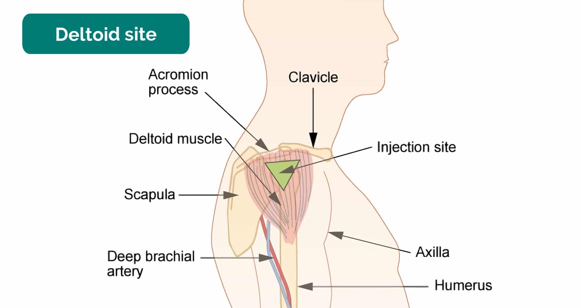 Intramuscular Vitamin Training Course